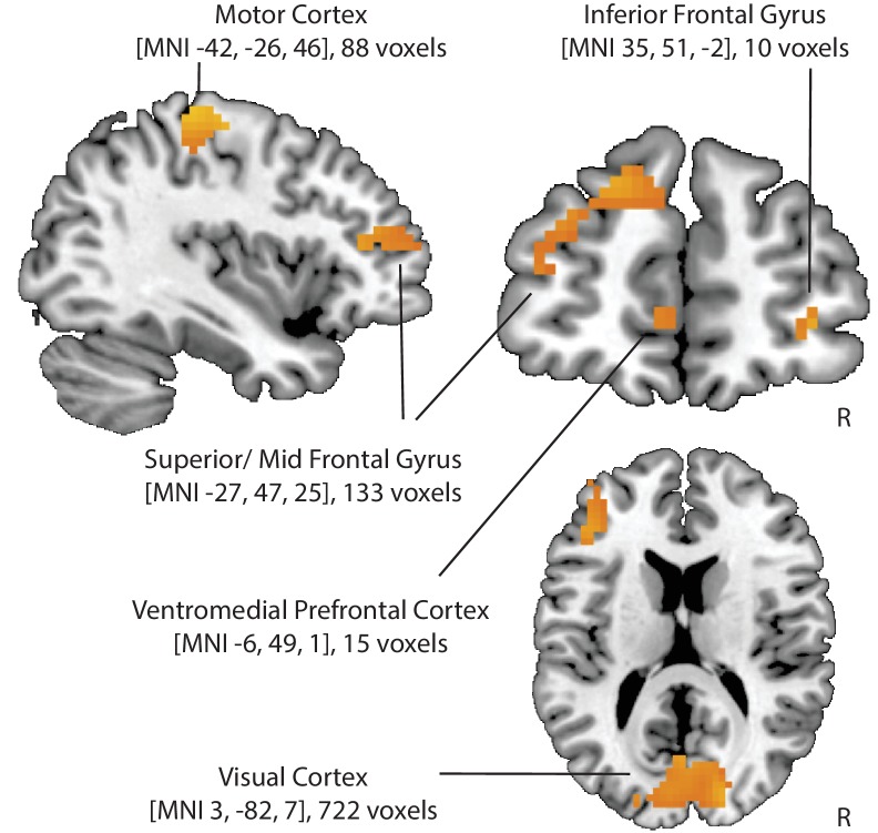 Figure 3—figure supplement 1.