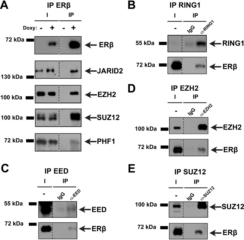 Interaction Proteomics Identifies ERbeta Association with Chromatin ...