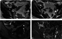 Fig. 11