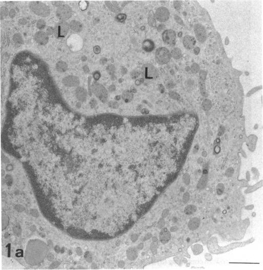 FIGURE 1. 1a