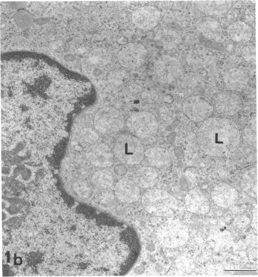 FIGURE 1. 1b