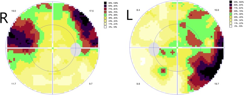 Fig. 4