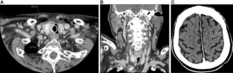 Figure 6