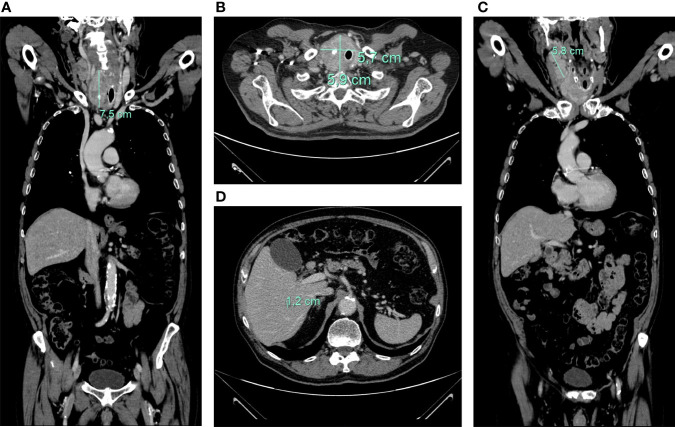 Figure 2