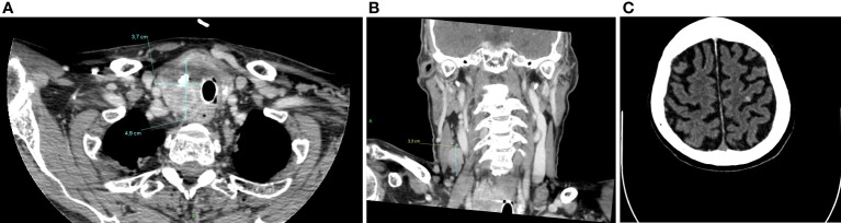 Figure 4