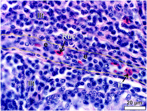 Figure 14