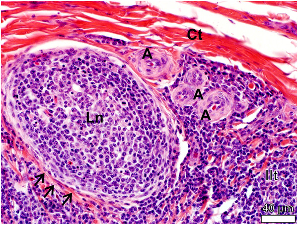 Figure 13