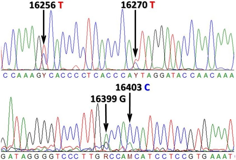 Fig 1