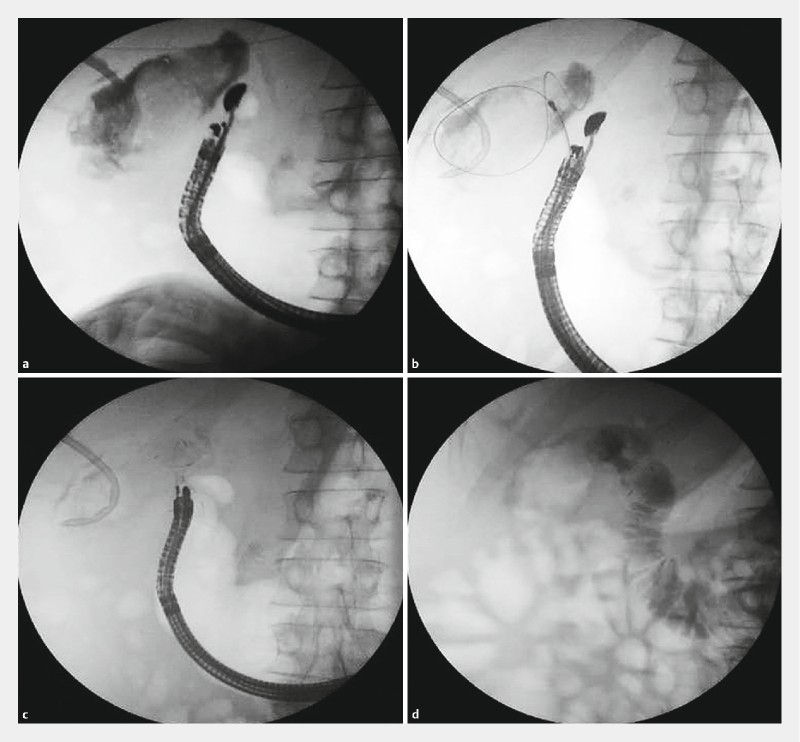 Fig. 2