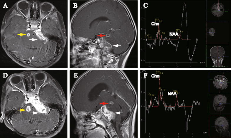 Fig. 2