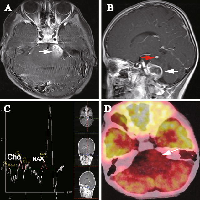 Fig. 1