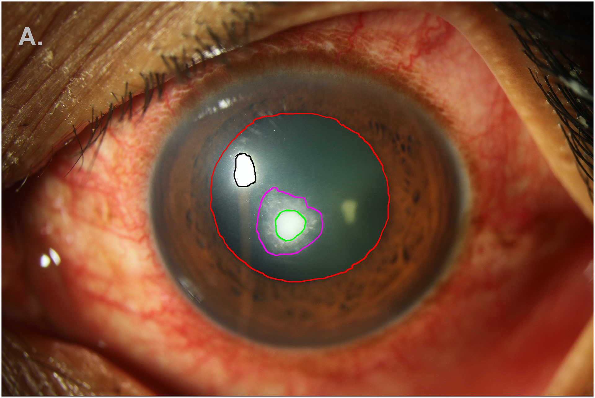 Figure 1A