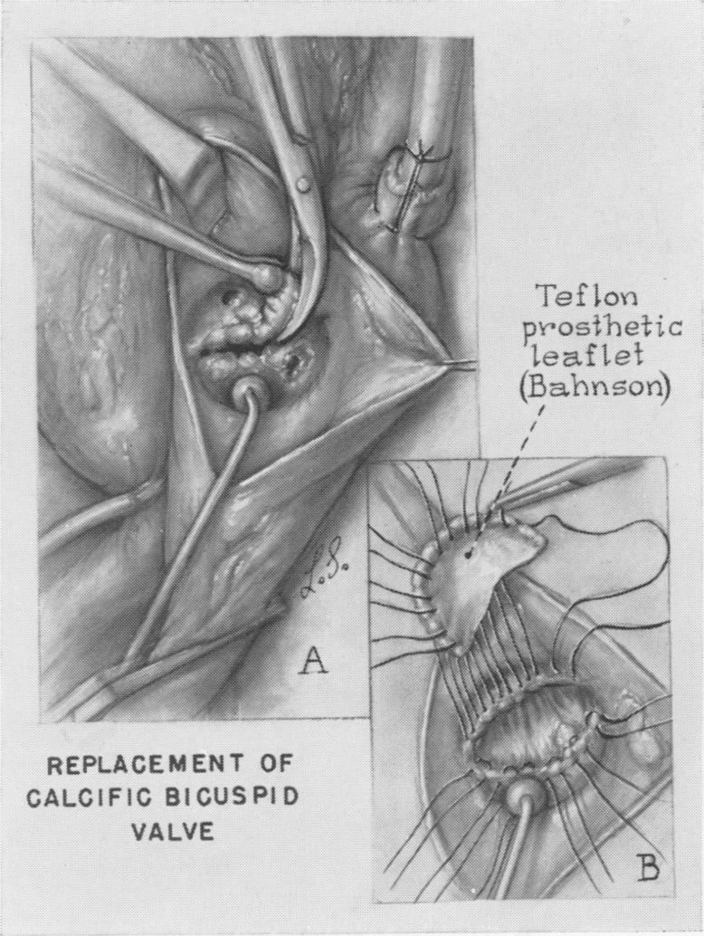 Fig. 11.