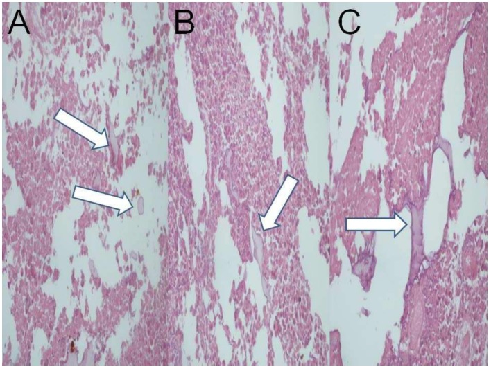 Figure 17