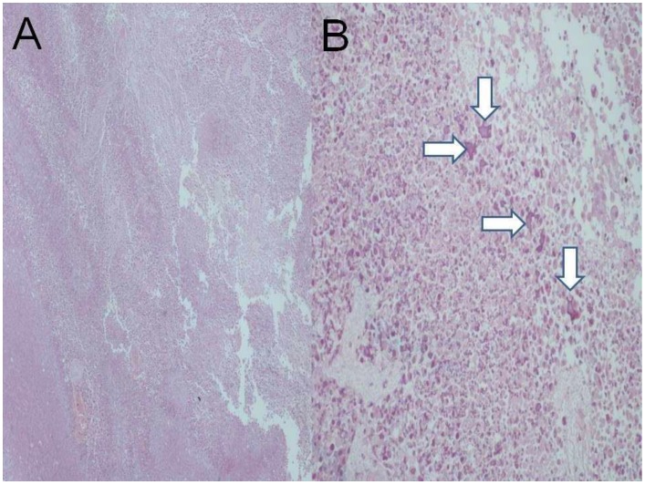 Figure 16