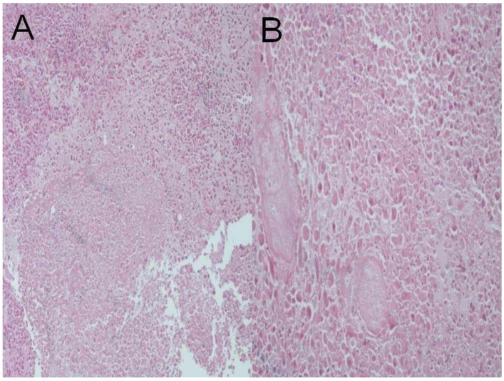 Figure 14