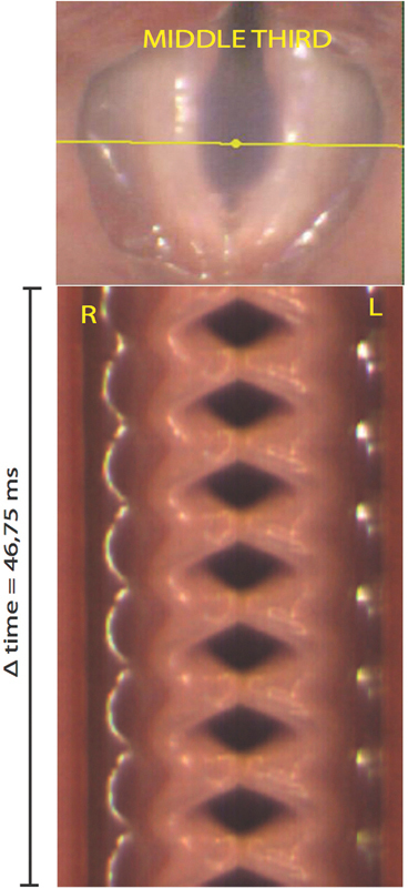 Fig. 3