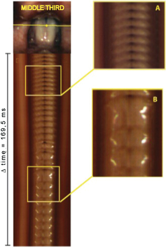 Fig. 11