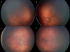 FIG 1