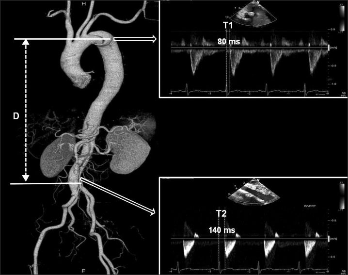 FIG. 4