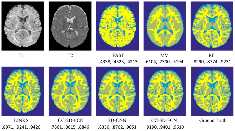 Fig. 16.