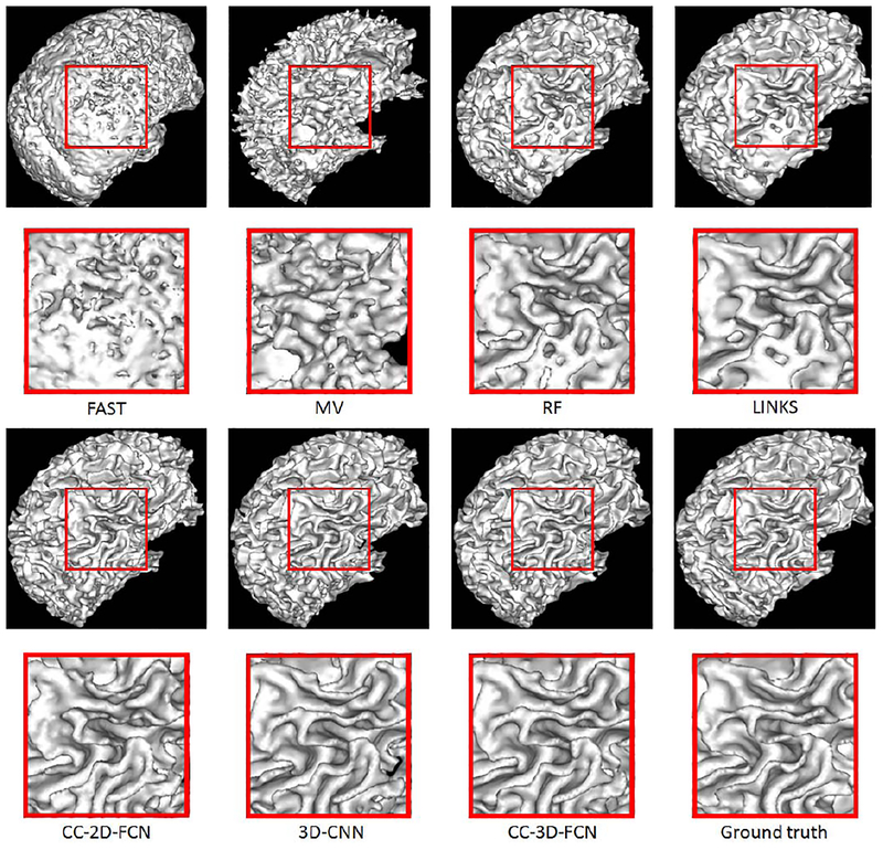 Fig. 15.