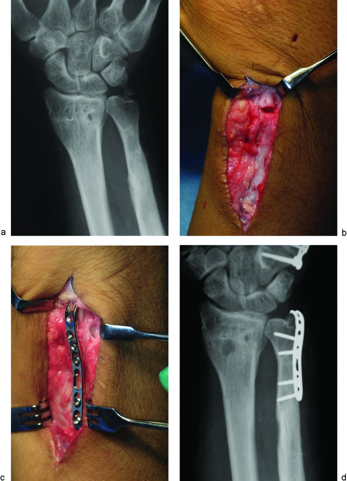 Fig. 4a–d 