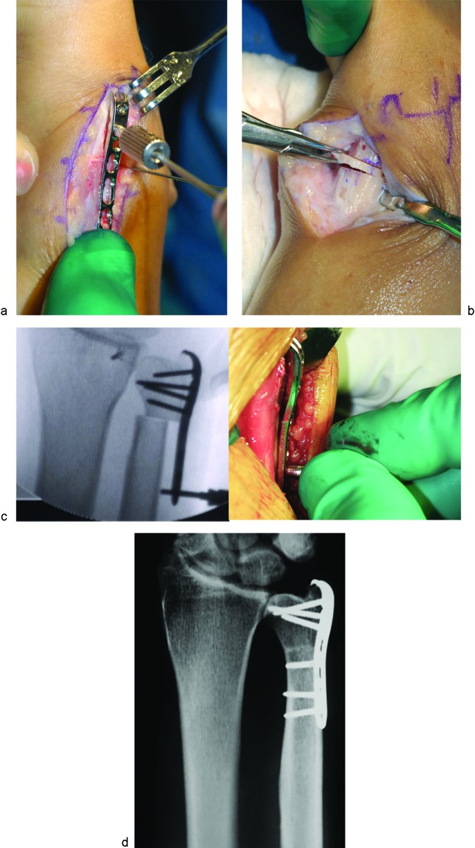 Fig. 5a–d 