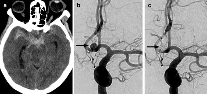 Fig. 1