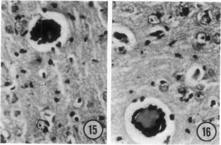 Fig 15 and 16