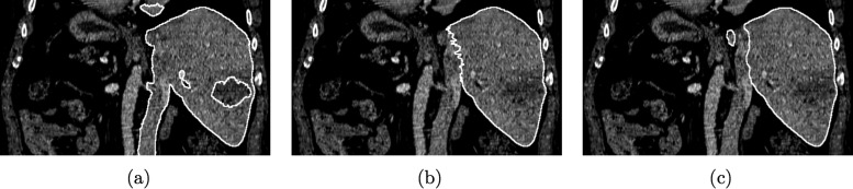 FIG. 15.