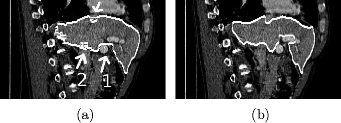 FIG. 14.