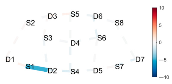 graphic file with name brainsci-11-00742-i026.jpg