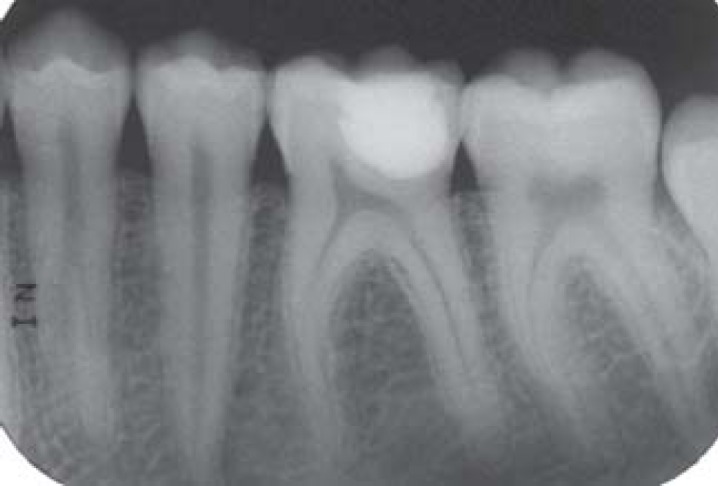 FIGURE 11