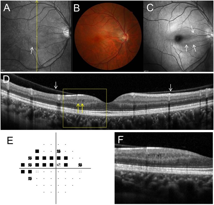 Fig 4