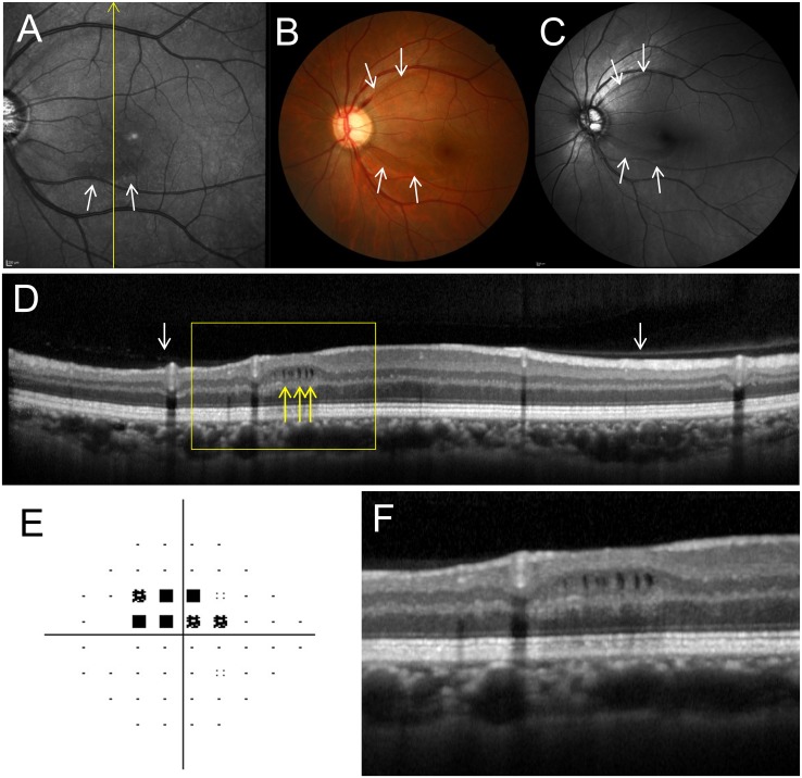 Fig 3