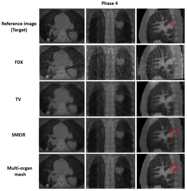 Figure 15