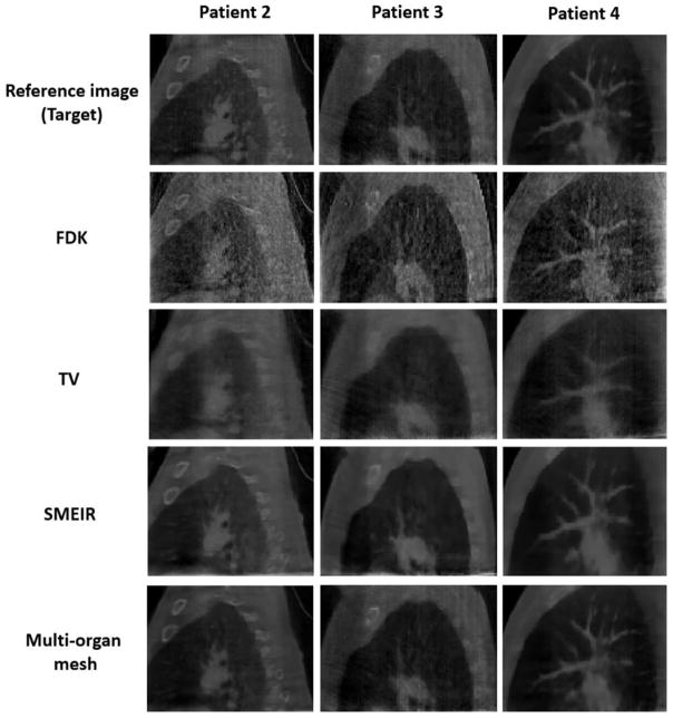 Figure 18