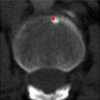 Figure 9b: