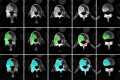 Figure 5a:
