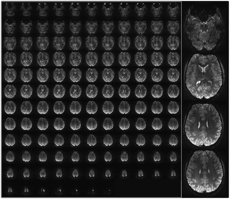 Fig. 14