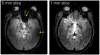Fig. 12