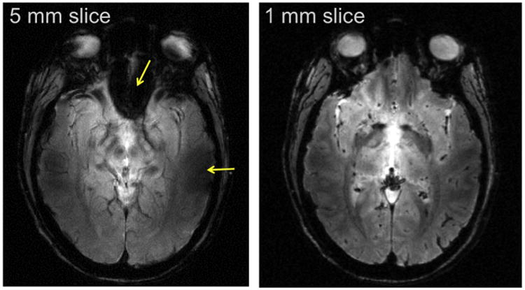 Fig. 12