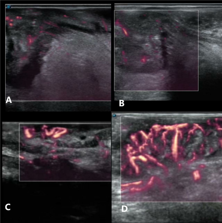 Fig. 6