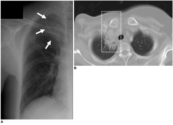 Fig. 11