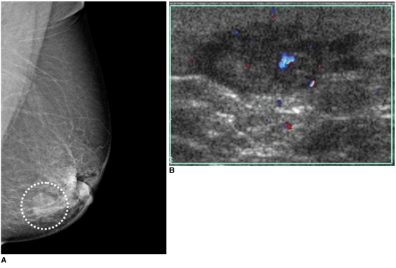 Fig. 13