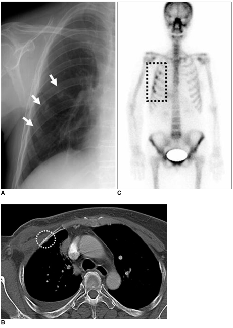 Fig. 12