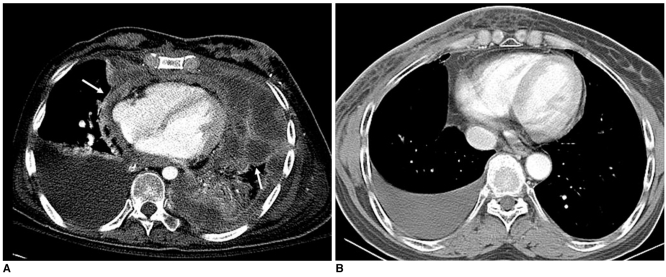 Fig. 16