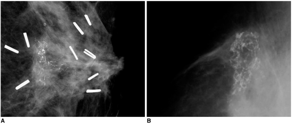 Fig. 14