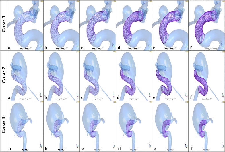 Fig. 1